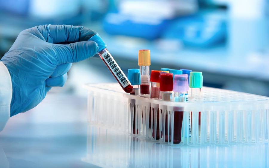 Blood Test