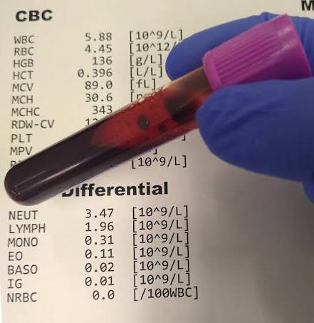 Complete Blood Count